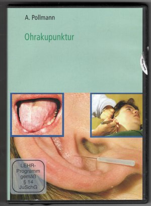 Ohrakupunktur mit Sekundeneffekt 1-3 [3 DVDs]