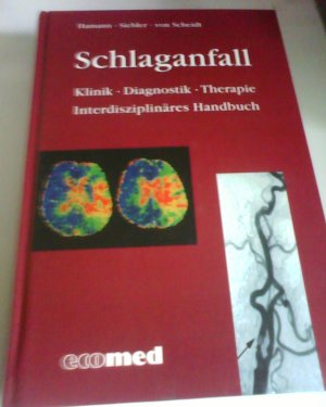 Schlaganfall: Klinik-Diagnostik-Therapie. Interdisziplinäres Handbuch