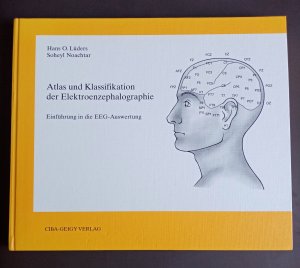 Atlas und Klassifikation der Elektroenzephalographie