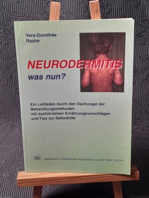 Neurodermitis - was nun?