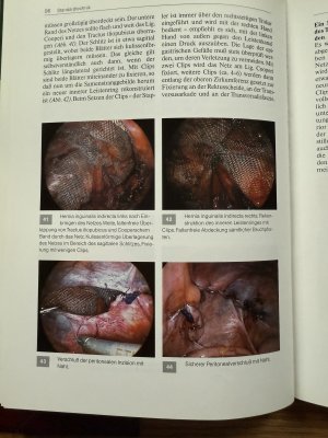 gebrauchtes Buch – Reinhard Bittner – Laparoskopische Hernioplastik