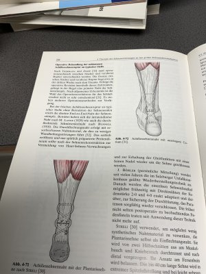 gebrauchtes Buch – Geldmacher, Jürgen; Köckerling, Ferdinand; Marchtaler, Ingrid von – Sehnenchirurgie