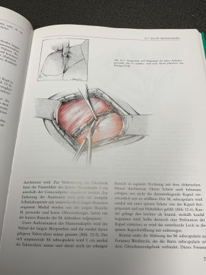 gebrauchtes Buch – Habermeyer, P; Schweiberer – Schulterchirurgie