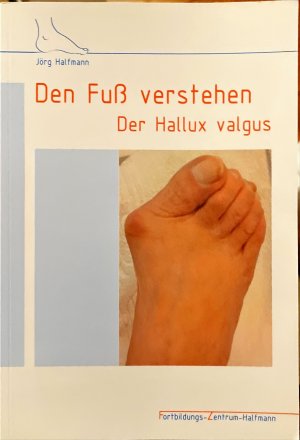 Den Fuß verstehen. Der Hallux valgus