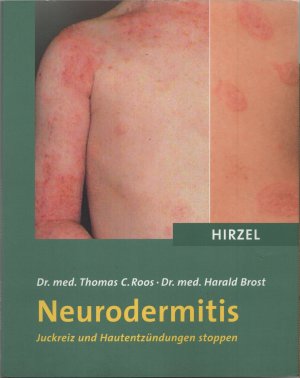 gebrauchtes Buch – Roos, Dr. med – Neurodermitis - Juckreiz und Hautentzündungen stoppen