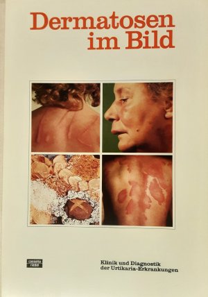 gebrauchtes Buch – Dermatosen im Bild Klinik und Diagnostik der Urticaria Erkrankungen