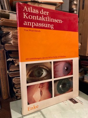 Atlas der Kontaktlinsenanpassung