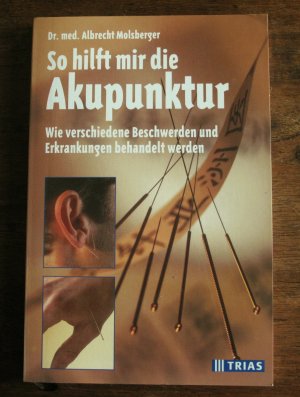 So hilft mir die Akupunktur