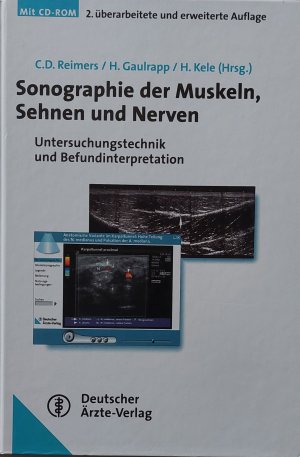 Sonographie der Muskeln, Sehnen und Nerven