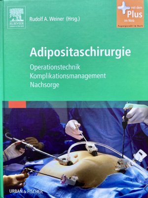 Adipositaschirurgie - Operationstechnik - Komplikationsmanagement - Nachsorge