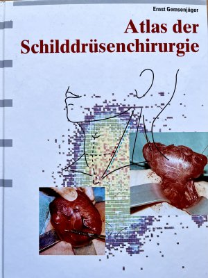 Atlas der Schilddrüsenchirurgie - ein chirurgisch-klinisches Lehrbuch