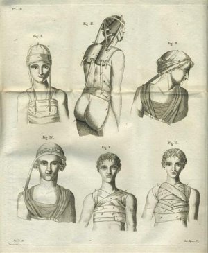 Traité des bandages et appareils, à l'usage des chirurgiens des armées.