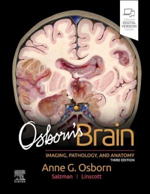 neues Buch – Anne G. Osborn – Osborn's Brain