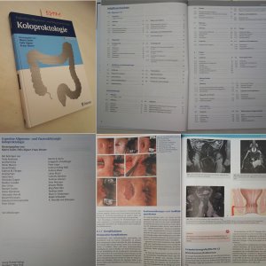 gebrauchtes Buch – Marco Sailer / Felix Aigner / Franc Hetzer – Koloproktologie. Expertise Allgemein- und Viszeralchirurgie