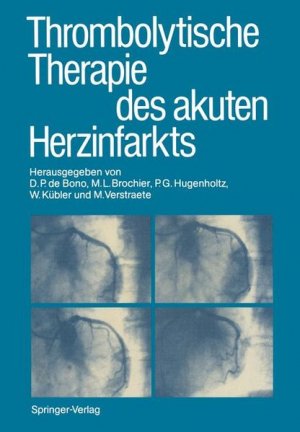 gebrauchtes Buch – Thrombolytische Therapie des akuten Herzinfarkts (German Edition)