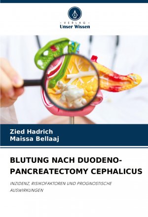 neues Buch – Zied Hadrich – BLUTUNG NACH DUODENO-PANCREATECTOMY CEPHALICUS | INZIDENZ, RISIKOFAKTOREN UND PROGNOSTISCHE AUSWIRKUNGEN | Zied Hadrich (u. a.) | Taschenbuch | Paperback | 80 S. | Deutsch | 2024 | Verlag Unser Wissen