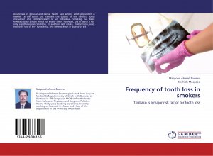 Frequency of tooth loss in smokers