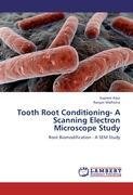 Tooth Root Conditioning- A Scanning Electron Microscope Study