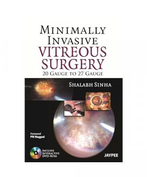 Minimally Invasive Vitreous Surgery: 20 Gauge to 27 Gauge