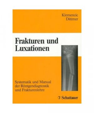 gebrauchtes Buch – Klemencic, J /Dittmer, Hartmut – Frakturen und Luxationen