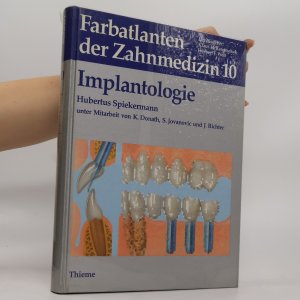 gebrauchtes Buch – Hubertus Spiekermann – Implantologie