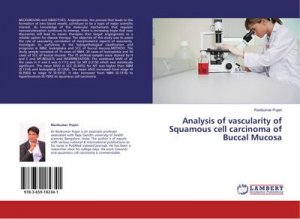 Analysis of vascularity of Squamous cell carcinoma of Buccal Mucosa