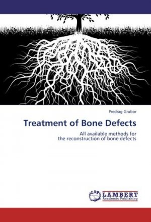 Treatment of Bone Defects