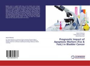 Prognostic Impact of Apoptosis Markers (Fas & FasL) in Bladder Cancer