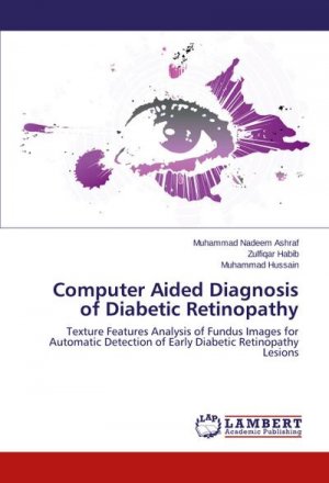 Computer Aided Diagnosis of Diabetic Retinopathy