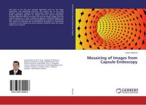 Mosaicing of Images from Capsule Endoscopy