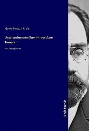 Untersuchungen über intraoculare Tumoren