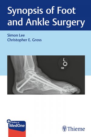 ISBN 9781626237247: Synopsis of Foot and Ankle Surgery