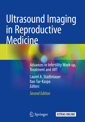 ISBN 9783030167011: Ultrasound Imaging in Reproductive Medicine - Advances in Infertility Work-up, Treatment and ART