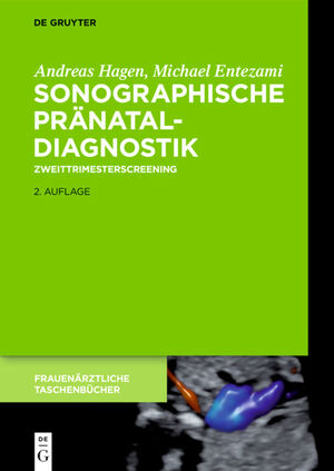 ISBN 9783110647129: Sonographische Pränataldiagnostik - Zweittrimesterscreening