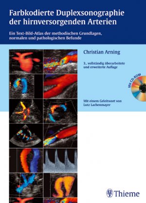 ISBN 9783131021335: Farbkodierte Duplexsonographie der hirnversorgenden Arterien (mit 72 Videosequenzen auf CD-ROM)