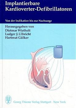 ISBN 9783131065216: Implantierbare Kardioverter-Defibrillatoren (ICD):