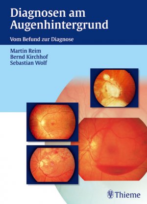 gebrauchtes Buch – Prof. Dr. Martin Reim (Autor) Ordinarius für Augenheilkunde Leiter Abteilung für Augenheilkunde von der Medizinischen Fakultät der RWTH – Diagnosen am Augenhintergrund Vom Befund zur Diagnose (Gebundene Ausgabe) Augenkrankheit Augenheilkunde Netzhaut Sehnerv Intraokular Okulär Ophthalmologie Auge Optiker Augenkliniken Deutsche Ophthalmo