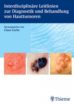 ISBN 9783131339010: Interdisziplinäre Leitlinien zur Diagnostik und Behandlung von Hauttumoren von Claus Garbe