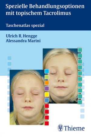 ISBN 9783131345714: Spezielle Behandlungsoptionen mit topischem Tacrolimus. Taschenatlas spezial