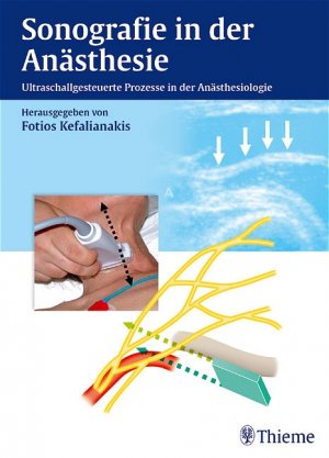Fotios Kefalianakis - Sonographie in der Ansthesie. Ultraschallgesteuerte Prozesse in der Ansthesiologie