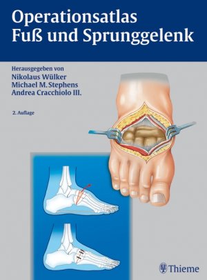 ISBN 9783131425928: Operationsatlas Fuß und Sprunggelenk [Gebundene Ausgabe] Nikolaus Wülker HandChirurgie Fußchirurgie Chirurgie OP-Lehren Atlanten Chirurgie Unfallchirurgie Fuß Fusschirurgie Fußerkrankungen Medizin Kli