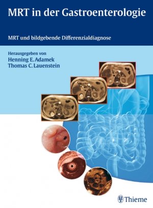 Henning Ernst Adamek (Herausgeber), Thomas Lauenstein (Herausgeber), Jrg Albert (Mitwirkende), Regina Beets-Tan (Mitwirkende), Jrgen Bunke (Mitwirkende), Siegbert Faiss (Mitwirkende), Lucas Greiner (Mitwirkende), Renate Hammerstingl (Mitwirkende), Dirk - MRT in der Gastroenterologie: MRT und bildgebende Differenzialdiagnose Gebundene Ausgabe