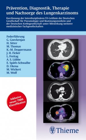 ISBN 9783131664112: Prävention, Diagnostik, Therapie und Nachsorge des Lungenkarzinoms - Kurzfassung der Interdisziplinären S3-Leitlinie der Dt. Gesellschaft f. Pneumolo