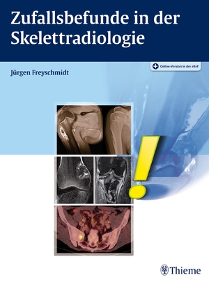 ISBN 9783131981912: Zufallsbefunde in der Skelettradiologie