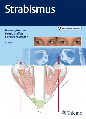 ISBN 9783132413306: Strabismus