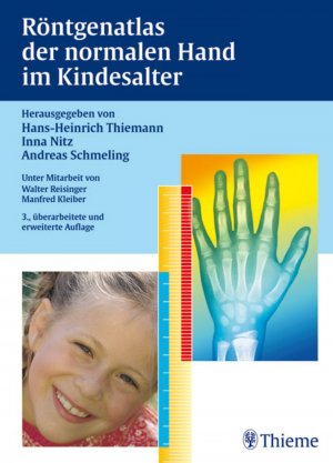 ISBN 9783137666035: Röntgenatlas der normalen Hand im Kindesalter