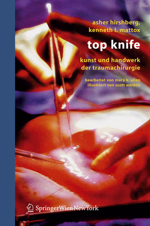 ISBN 9783211329184: Top Knife | Kunst und Handwerk der Trauma-Chirurgie | Asher Hirshberg (u. a.) | Taschenbuch | Paperback | XII | Deutsch | 2006 | Springer Vienna | EAN 9783211329184