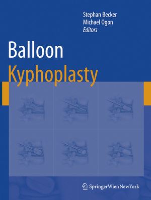ISBN 9783211742204: Balloon Kyphoplasty