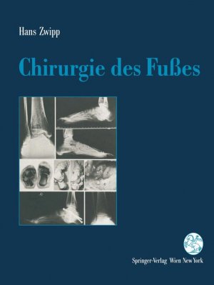 gebrauchtes Buch – Hans Zwipp – Chirurgie des Fußes