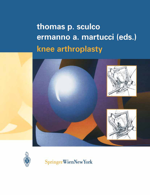 ISBN 9783211835319: Knee Arthroplasty